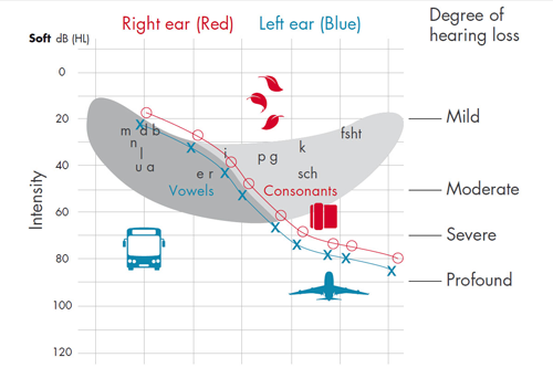 audiograma-hp-img https://wesound.ro/wp-content/uploads/2020/10/audiograma-hp-img-1.png